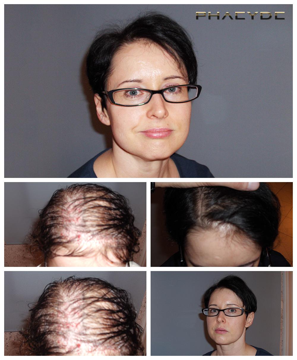 Hair Restavriranje Ženska